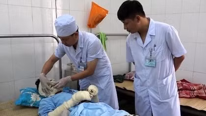 Đun nước trong đám tang, 5 người bị thương do nổ khí gas