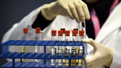 VĐV Malaysia "dính" doping tại SEA Games 29