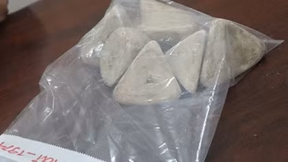 Lấy 0,5kg sỏi từ bàng quang của bệnh nhân