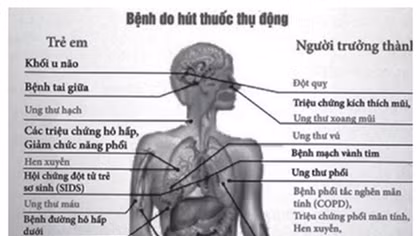 Mỗi năm Việt Nam có khoảng 40.000 người tử vong do thuốc lá