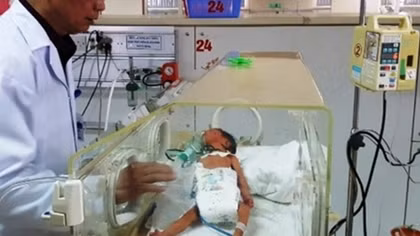 Cứu sống bé gái sơ sinh bị dị tật thực quản hiếm gặp