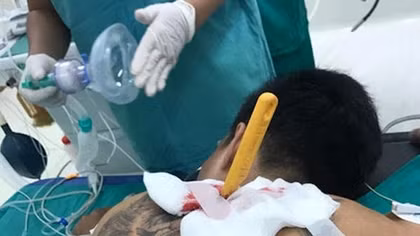 Nam thanh niên xăm trổ bị bạn gái cầm dao đâm lút cán