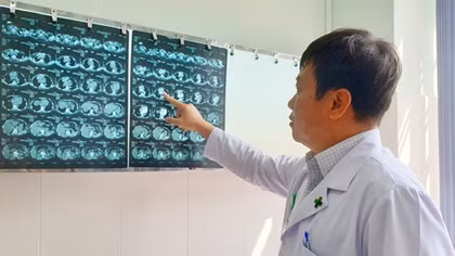 Phẫu thuật khối bướu giáp thòng trong lồng ngực