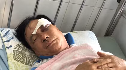 Con rể đánh bố vợ nhập viện cấp cứu