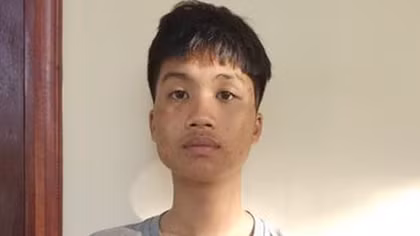 Tạm giam thanh niên dùng gậy đập xe máy sau va chạm với bà bầu 