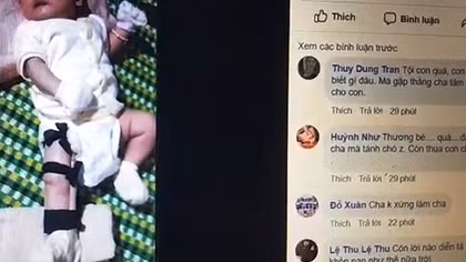 Dựng chuyện con 2 tháng tuổi bị cha đạp gãy chân đăng Facebook xin tiền 