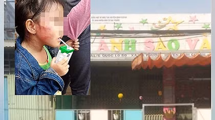 Đưa bảo mẫu về trụ sở Công an để làm rõ hành vi bạo hành