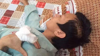 Đang ăn đêm, chủ cửa hàng massage bị côn đồ bịt mặt chém xối xả