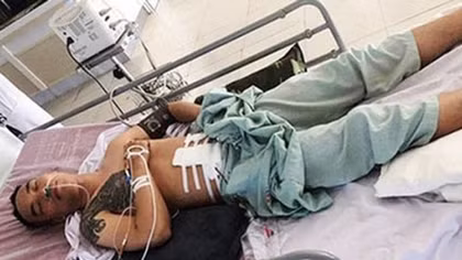 Hai nghi can bắn 2 người bị trọng thương ở Nghệ An đã ra đầu thú