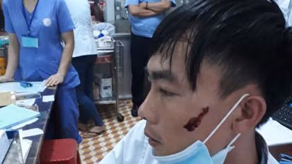 Người nhà bệnh nhân vô cớ đánh nam điều dưỡng nhập viện