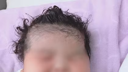 Bé gái sơ sinh ở Sóc Trăng nặng 6,1 kg 