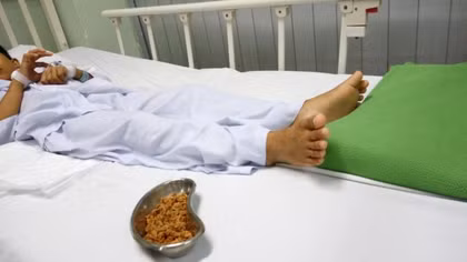 Em bé 11 tuổi nhập viện vì 70g hạt sơ-ri nảy mầm trong hậu môn