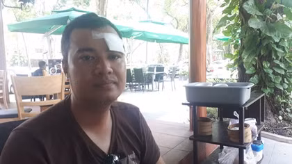 Không đòi được nợ còn bị đánh trọng thương