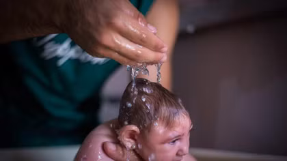 Số người mắc bệnh do virus Zika tăng nhanh