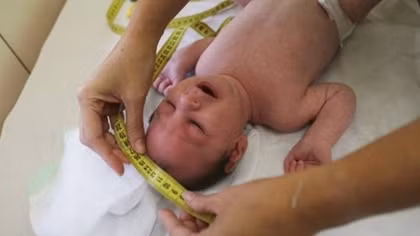 Phụ nữ mang thai cần siêu âm đầy đủ để phát hiện sớm Zika