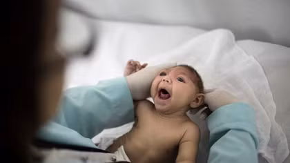 Xuất hiện 2 trường hợp mắc chứng đầu nhỏ do virut Zika đầu tiên ở Đông Nam Á 