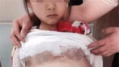 Bé gái 12 tuổi đi khám thai, hé lộ đường dây buôn người ở Trung Quốc