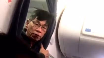 BS người Mỹ gốc Việt khởi kiện United Airlines
