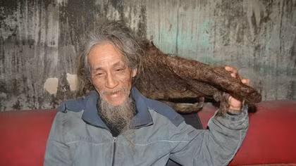 Chuyện về người đàn ông có mái tóc kỳ quái