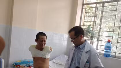Cảnh báo nhiều trường hợp phải mất chân tay vì bỏng điện