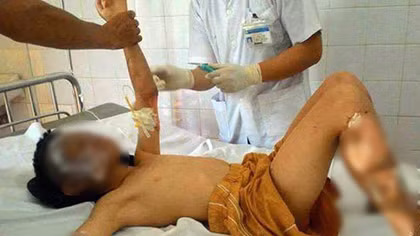 Nổ khí gas ở Lào Cai, 10 người bị thương