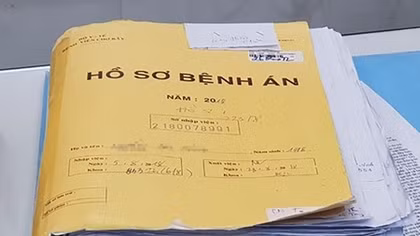 "Bỗng dưng" tâm thần
