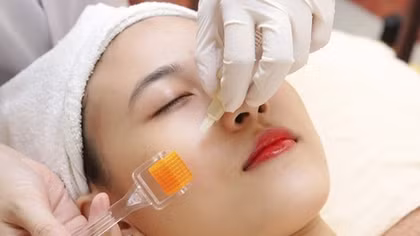Làm đẹp “lăn kim” xong phải nhập viện gấp