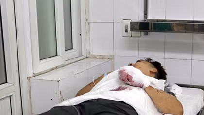 Tai nạn do pháo gia tăng những ngày Tết: Bài học không thừa