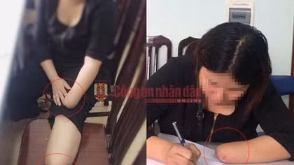 Vụ thuê người chặt chân, tay để trục lợi bảo hiểm: Có dấu hiệu tội "Cố ý gây thương tích"