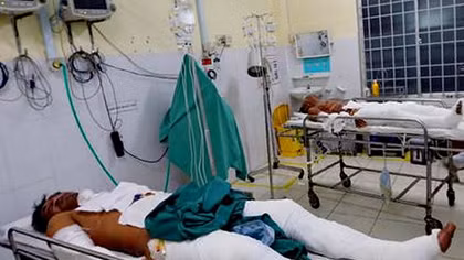 "Đùa" với xăng, 5 thanh niên bị bỏng khi đang nhậu