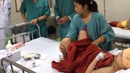 Tái tạo thành công khuôn mặt cho bệnh nhi bị dị tật hiếm gặp