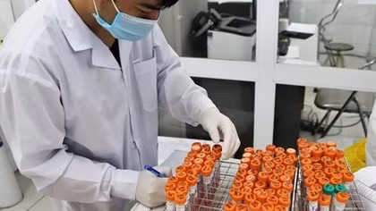 Yêu cầu 4 tỉnh khẩn trương điều tra, truy vết, xét nghiệm trên diện rộng