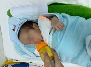Phẫu thuật cho bệnh nhi sơ sinh bị dị dạng đường dẫn khí phổi bẩm sinh