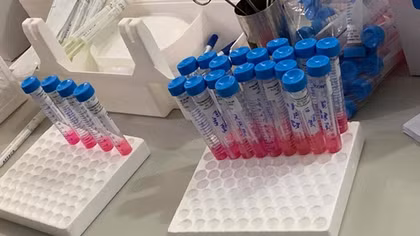 Tại sao phải gộp mẫu để xét nghiệm virus SARS-CoV-2 
