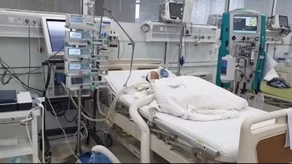 Cứu bé trai suýt tử vong do tổn thương não vì tay chân miệng 