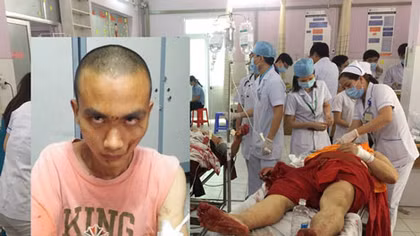 Rùng mình đối diện cặp mắt của sát nhân khoác áo cà sa