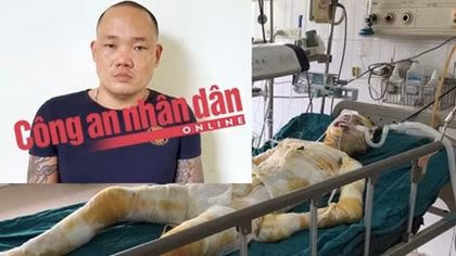 Bắt được hung thủ dùng xăng phóng hỏa 2 cô gái bị bỏng nặng