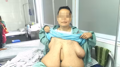 Người mẹ có bộ ngực khổng lồ nhưng con khát sữa cần giúp đỡ