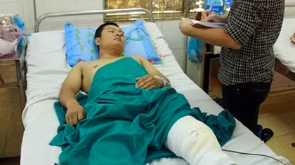 Đã xác định được đối tượng ném đá khiến CSGT bị thương