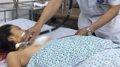 Cứu sống bé gái bị mảnh thủy tinh xuyên thấu ngực