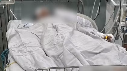 Vụ phóng hỏa 2 người chết tại tỉnh Gia Lai: Bệnh nhi 5 tuổi tạm qua cơn nguy kịch