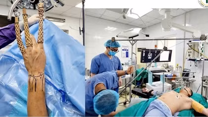 Bệnh viện 19-8 phẫu thuật nội soi nối rách đĩa sụn sợi tam giác cổ tay với trợ cụ đặc biệt tự tạo