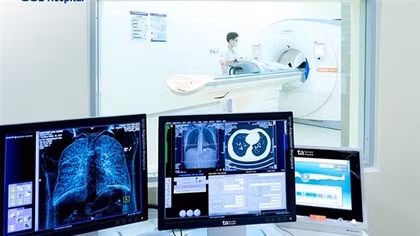 Ung thư phổi sau nhiều năm hút thuốc lá