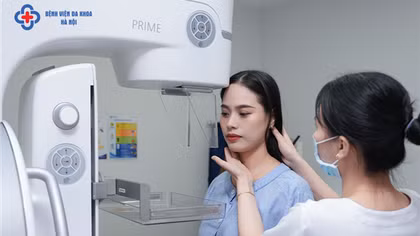 Phát hiện ung thư ở cả 2 vú khi chụp nhũ ảnh 3D