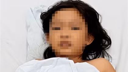 Cứu sống bệnh nhi 9 tuổi bị ngộ độc ốc biển chưa rõ danh tính