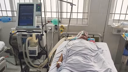 Ăn cá nóc, 4 người ở Cà Mau bị ngộ độc