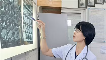 Lấy thành công xương cá dài hơn 1,5cm “trú” 5 tháng trong phế quản bệnh nhân