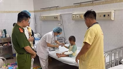 Công an Sơn La giúp đỡ cháu bé bị bỏng nặng