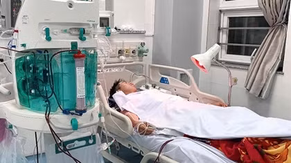 Vụ 4 người nhập viện ở Vũng Tàu: Can rượu 5 lít dương tính Methanol, đã uống còn nửa