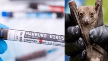 Tăng cường kiểm dịch, ngăn chặn ca bệnh Marburg từ cửa khẩu